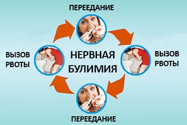 Лечение булимии в Берёзовском